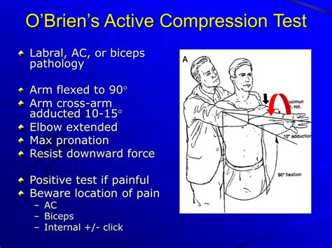 shoulder compression test positive|positive shoulder labral tear test.